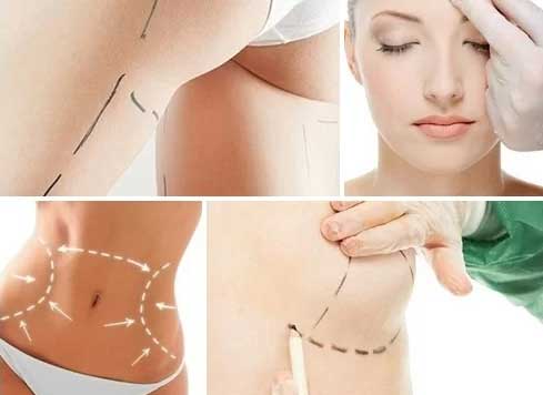 Cirurgia Plástica