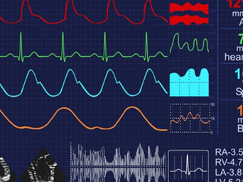 Exames cardiológicos: Ecocardiograma