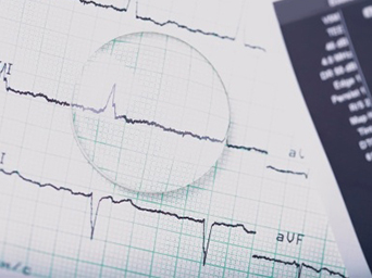 Exames cardiológicos: Holter